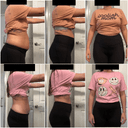 Freedom Weight Loss