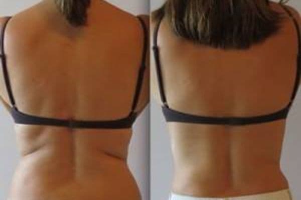 MercyOne Des Moines Weight Loss & Nutrition Center - clinic photo