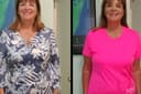 San Jose Weight Loss