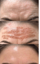YOLO Laser Center & Med Spa