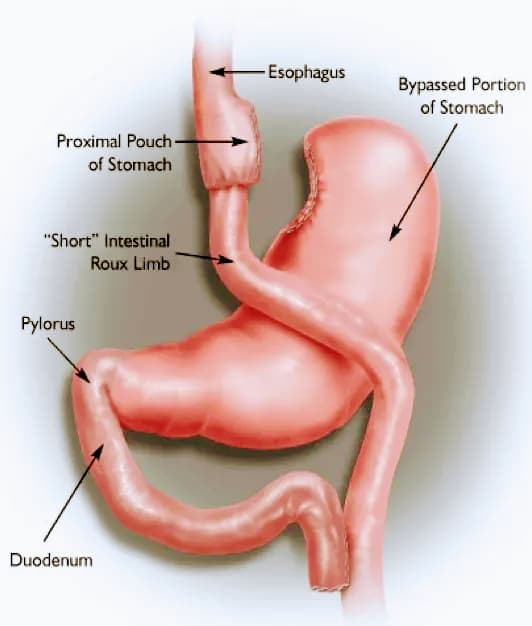Michigan Bariatric Surgery - Dr. Jason Rizqallah, MD - clinic photo
