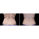 Genesis Lifestyle Medicine