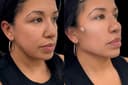 Med Spa NYC: Beso Aesthetics